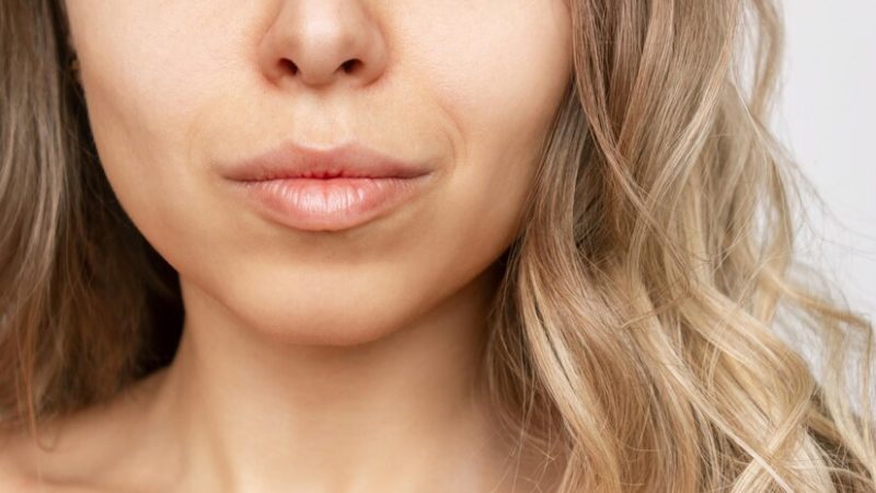 Comment se passe les injections de rides autour des lèvres