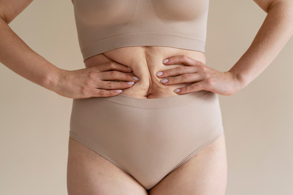 Lexique complet sur la lIposuccion