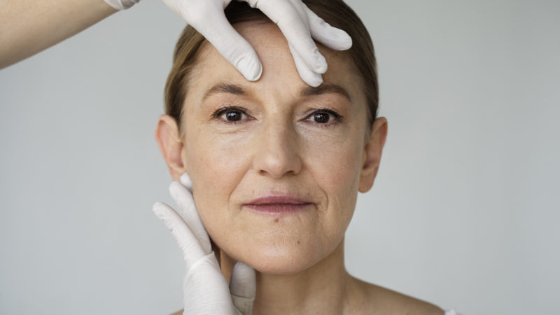 Pourquoi le lifting deep plane est mieux ?