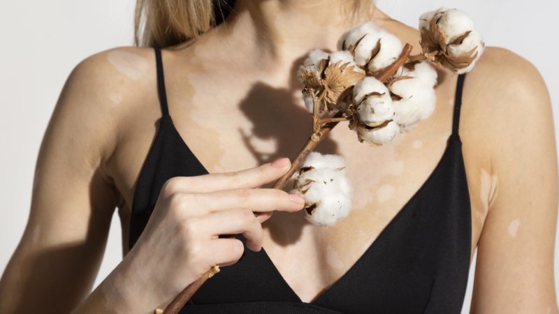 Les bienfaits pyschologiques de l&rsquo;augmentation mammaire pour une femme