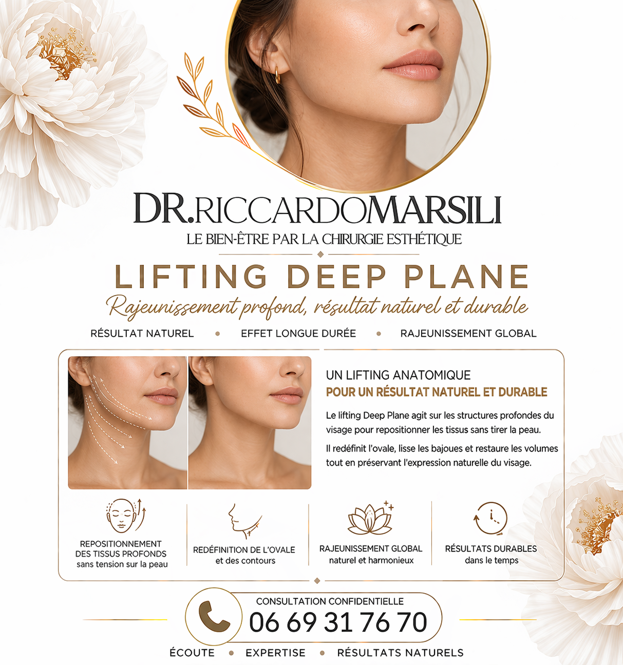 Lifting visage Deep plane Paris 75016